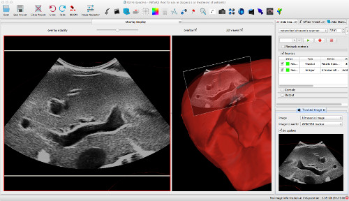 Screenshot-Ultrasound-Mac.jpg